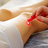 Laser Therapy for Spider Veins from Varicose Vein Treatments Center NY