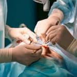 Comprehensive Facial Reconstructive Surgery