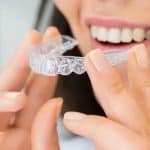 Invisalign in Yonkers NY: Platinum Invisalign Provider