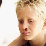 Does My Child Have A Broken Nose? Is It Early To Fix It?