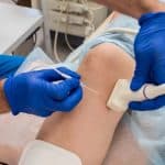 How Endovenous Laser Ablation Relieves Varicose Veins?