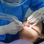 Treat Gum Disease with Osseous Surgery in Brooklyn
