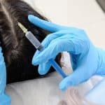 Expert Hair Restoration Solutions: Proven Treatments for Thinning