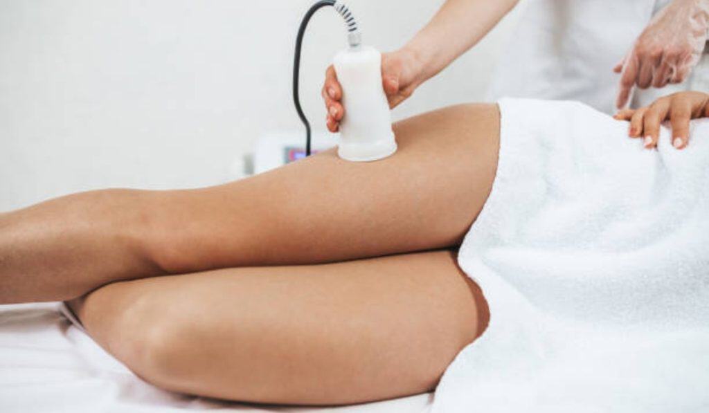 Aveli Cellulite Treatment